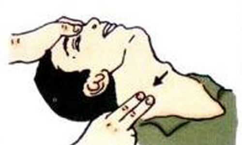 颈动脉体瘤的发病原因