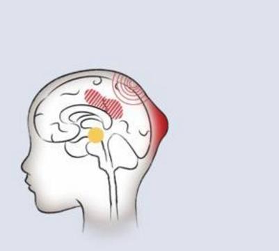https://img.miaoshoucdn.com/doctors/article/2019/02/06/201902060856315c5a30bf2c57c7625.jpg