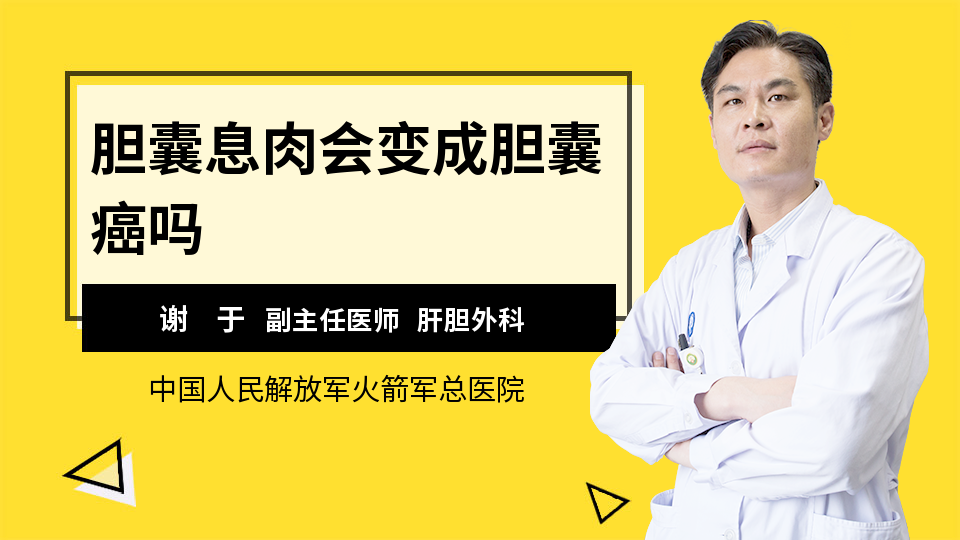 胆囊息肉会变成胆囊癌吗 谢于医生 视频问医生 妙手医生